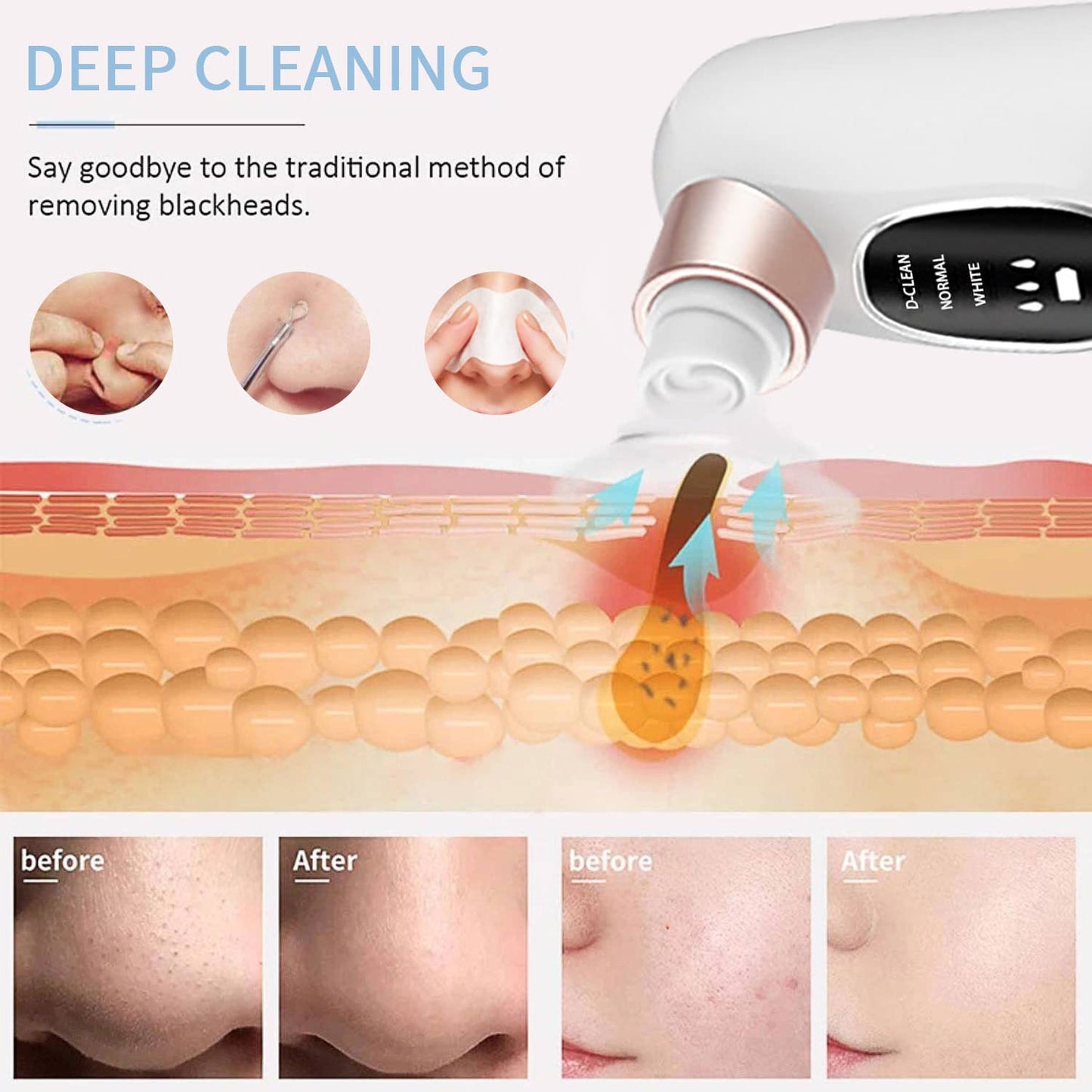 (Free Delivery) Fahlux Vacuum Pore Cleaner | Mini Hydra Facial Device
